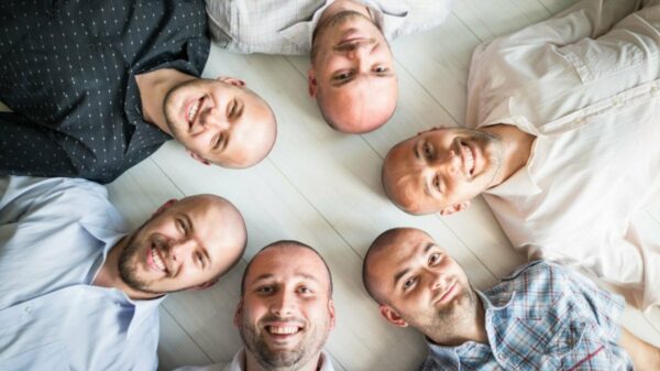 Itália é o 2º país do mundo com mais calvos